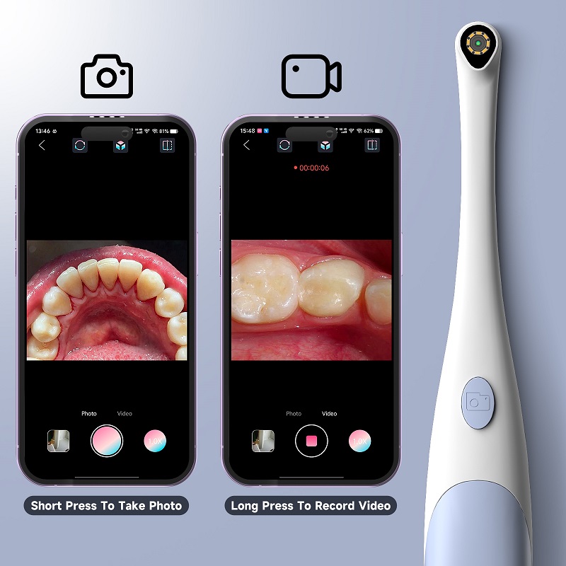 Oral Endoskop Kamera 1440P Fot - Photography Lighting Description incelemesi ve fiyatı